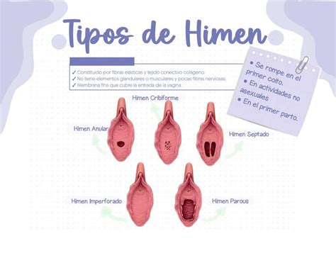 Tipos De Himen Xiomara Aguilar Udocz