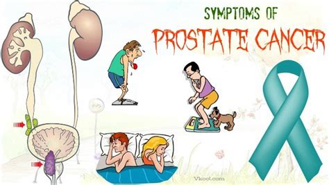 Top 7 Common Symptoms Of Prostate Cancer