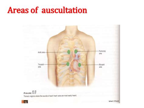 Auscultation Points For Breath Sounds 6