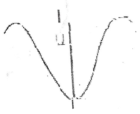 During Shm A Paricle Has Displacement X Form Mean Position If Accrel