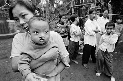 Vietnam War Agent Orange Effects