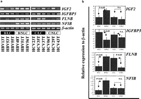 Rt Pcr To Validate Microarray Data The Expression Patterns Of Igf