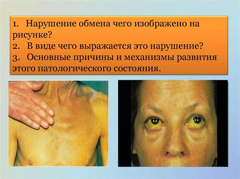 Вопросы по основам патологии - презентация онлайн
