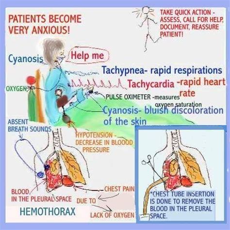 Nursing Study, Nursing Tips, Travel Nursing, Med Surg Nursing, Cardiac Nursing, Surgical Nursing ...