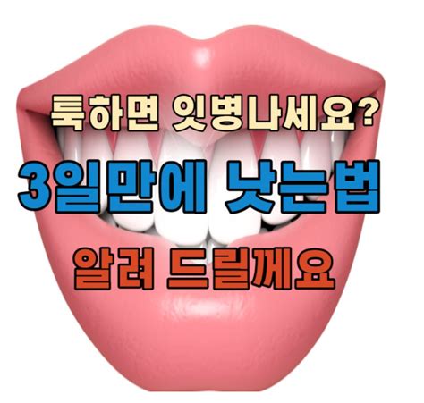 구내염 빨리 낫는법 딱 3가지만 기억하세요 네이버 블로그