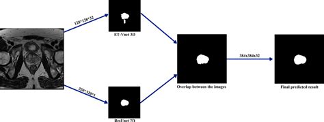 Segmentation Stages Of The Triple Fusion Model On Nciisbi 13