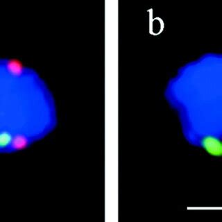 Fish With A Pan Centromere Probe Fluorescein Green And A