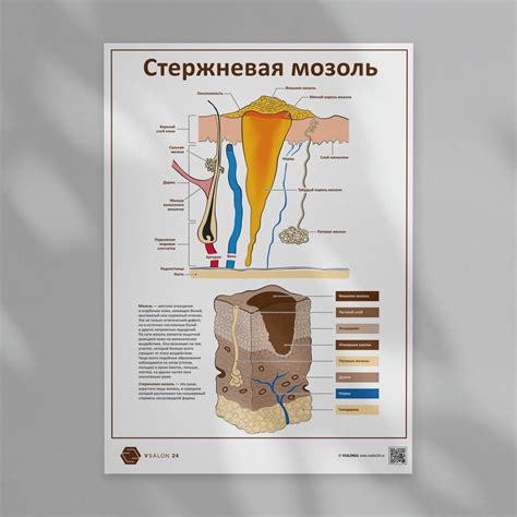 Стержневая мозоль [61 фотография]