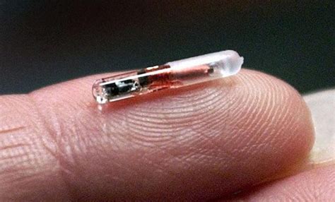 Implantes De Microchips En El Cuerpo