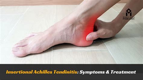 Insertional Achilles Tendinitis: Symptoms & Treatment