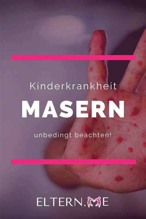 Pin auf Kinderkrankheiten