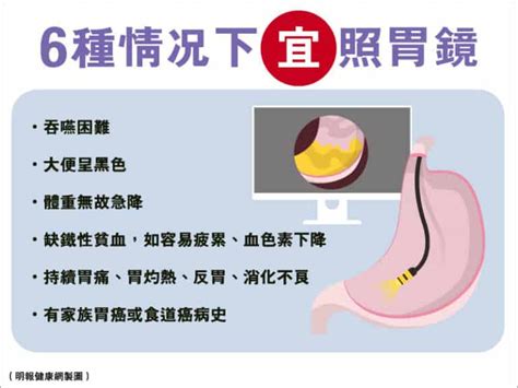 【胃癌】持續胃痛、胃灼熱、大便呈黑色、吞嚥困難、體重下降等6情况及早照胃鏡 拆解胃癌成因、徵狀和3種手術治療 明報健康網