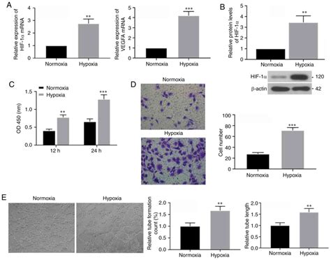 Long Noncoding Rna Norad Regulates Angiogenesis Of Human Umbilical