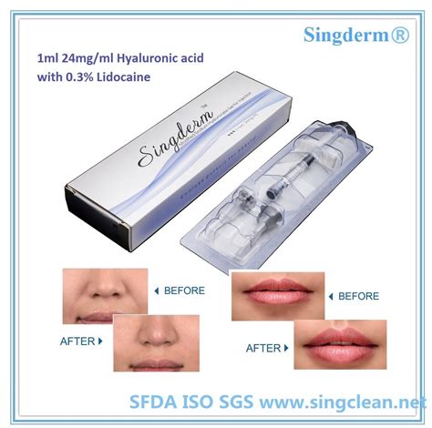 Years Hyaluronic Acid Dermal Filler Cosmetic Sodium Hyaluronate Gel