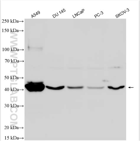 Dmrt1 Antibody 28149 1 Ap Proteintech 武汉三鹰生物技术有限公司