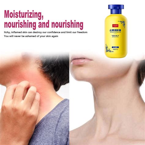 Anti Itch Body Lotion Dry Itchy Skin Skin Moisturizer Prevents Dry Skin Whitening Body Lotion