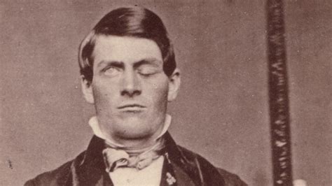 Phineas Gage The 170th Anniversary Of A Medical Oddity Daily Telegraph