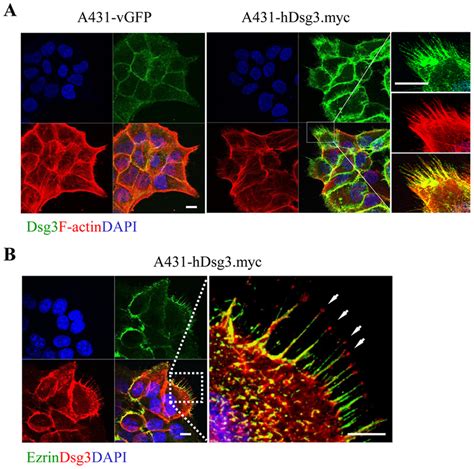 Formation Of Filopodia By Hdsg3myc Cells A Dual Labelling Of Dsg3