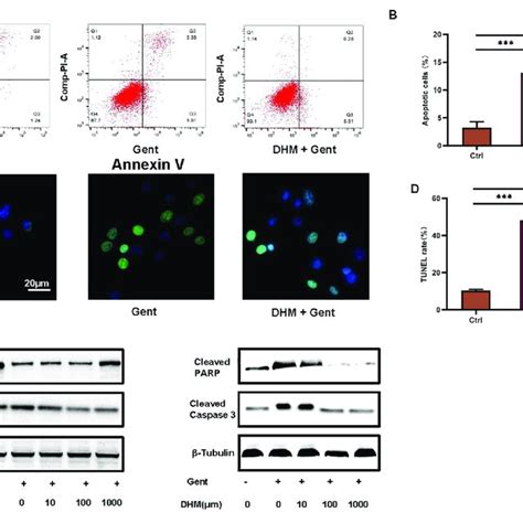 DHM Protects Against Gentamicin Induced Ototoxicity In HEI OC1 Cells