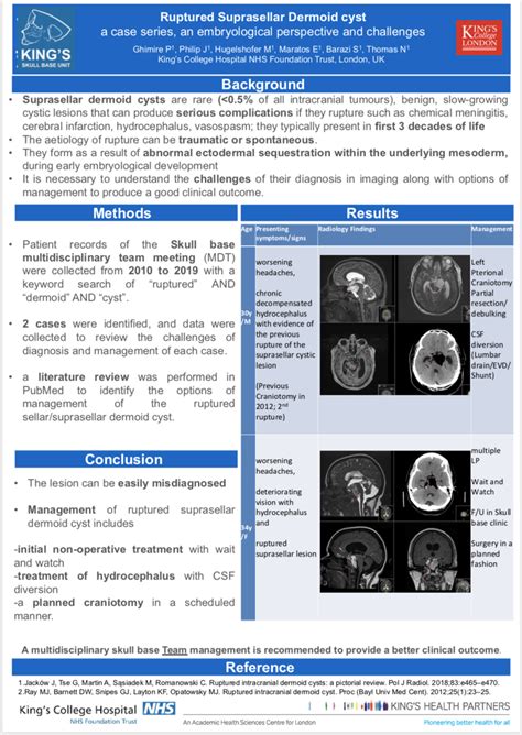 Pdf Ruptured Suprasellar Dermoid Cyst A Case Series An