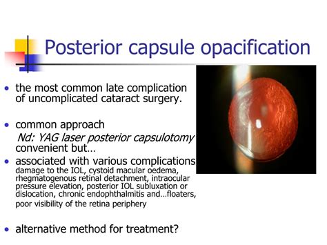 Ppt Posterior Capsule Opacification Treatment Ndyag Laser Vs Posterior Capsule Polishing