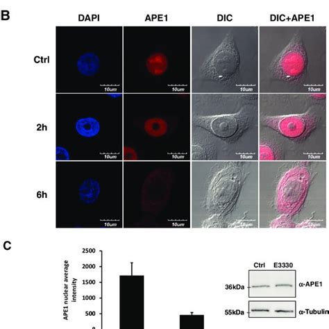 Ape1 Redox Inhibitor E3330 Affects Ape1 Nuclear Localization On Human