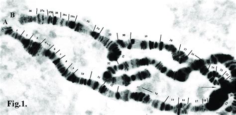 Polytene Chromosome Ab The Chromosome Was Divided To Sections In