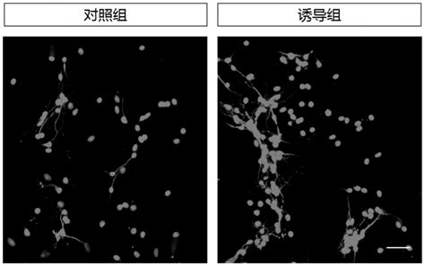 一种促进大鼠放射状胶质细胞向神经元分化的方法与流程