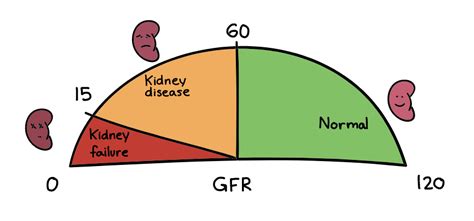 Pin on Nephrology