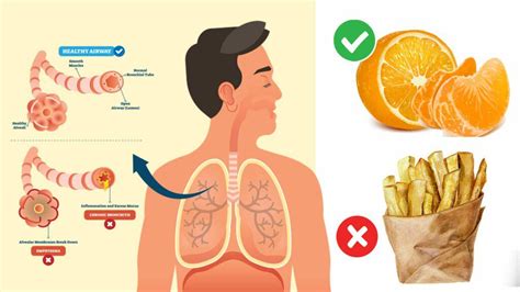 8 Foods To Heal Copd And 4 Things To Avoid