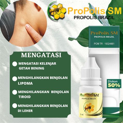 Jual Propolis Sm Brazilian Asli Obat Benjolan Tiroid Benjolan Lipoma