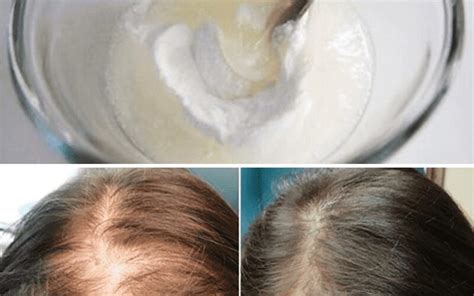 Baking Soda Shampoo Will Make Your Hair Grow Faster Than Ever Dr