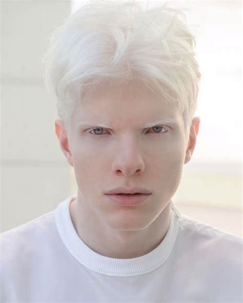 Albino Men Male Models Albino Model Just Beautiful Men Albino Human