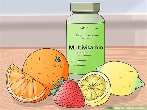 3 Ways To Reduce Bruising Wikihow Health