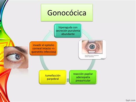 Conjuntivitis Bacteriana Ppt