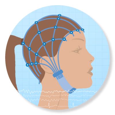 Universitätsklinikum Ulm Klinik für Neurologie Träger der