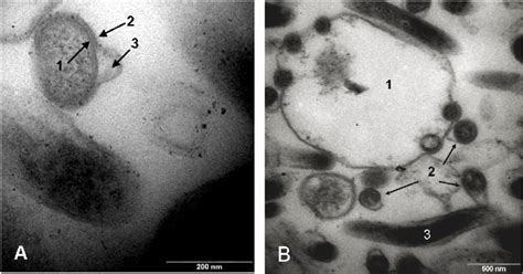 Borrelia Burgdorferi Bacteria Microscope