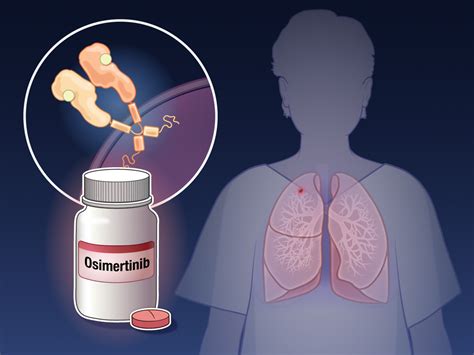 Osimertinib And Resected Egfr Mutated Nsclc New England Journal Of