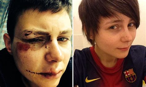 Oakham Supermarket Worker Beaten By Thugs Who Taunted Her For Being A Lesbian Daily Mail Online