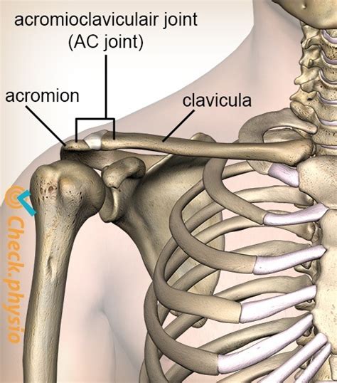 Acromioclavicular Joint Dislocation