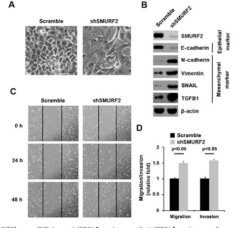 Figure 1 From Mir 15b Promotes Epithelial Mesenchymal Transition By