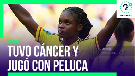 Linda Caicedo sobreviviente de cáncer tuvo que jugar con peluca YouTube