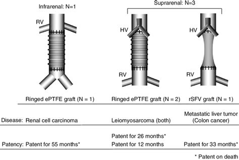 Interposition Graft