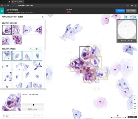 noul blog friable cervix glandular cells  inflammation