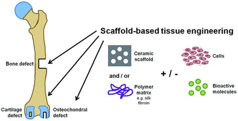 Schematic Representation Of Bone Tissue Engineering [39] Download Scientific Diagram