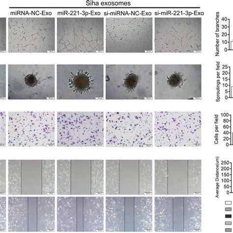 Cscc Exosomal Mir P Promotes Huvec Angiogenesis In Vitro Huvecs