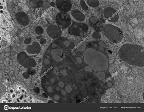 Lysosome Electron Micrograph