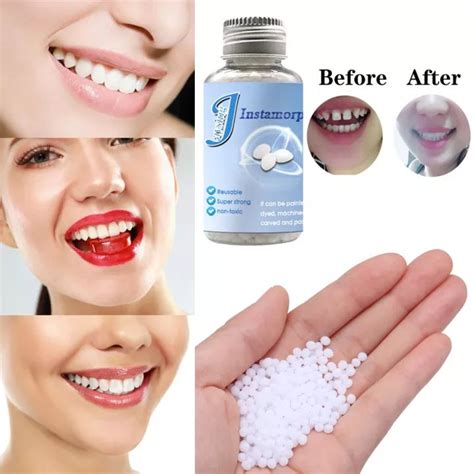 10 30g Falseteeth Teeth Solid Glue Fangs Fake Tooth Dentures Props Temporary Filling Teether