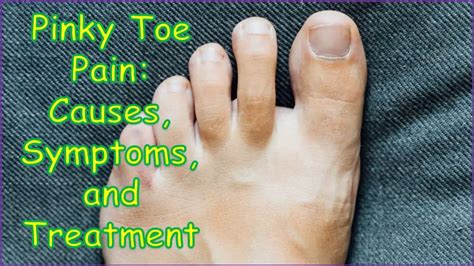 Pinky Toe Pain Causes Symptoms And Treatment