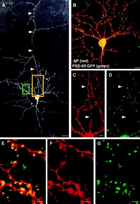 Molecular Determinants For Subcellular Localization Of Psd 95 With An